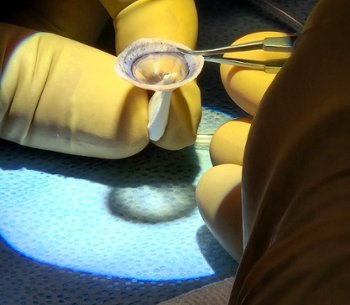 Kyle Nance distribution and processing supervisor at Rocky Mountain Lions Eye Bank doing cornea prep