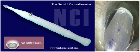 neusidl corneal inserter white on blue background next to a magnified image of the tip of the neusidl corneal inserter