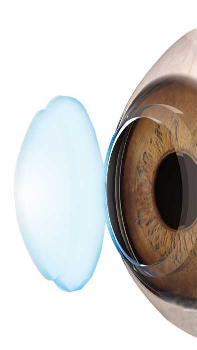Close up corneal tissue.